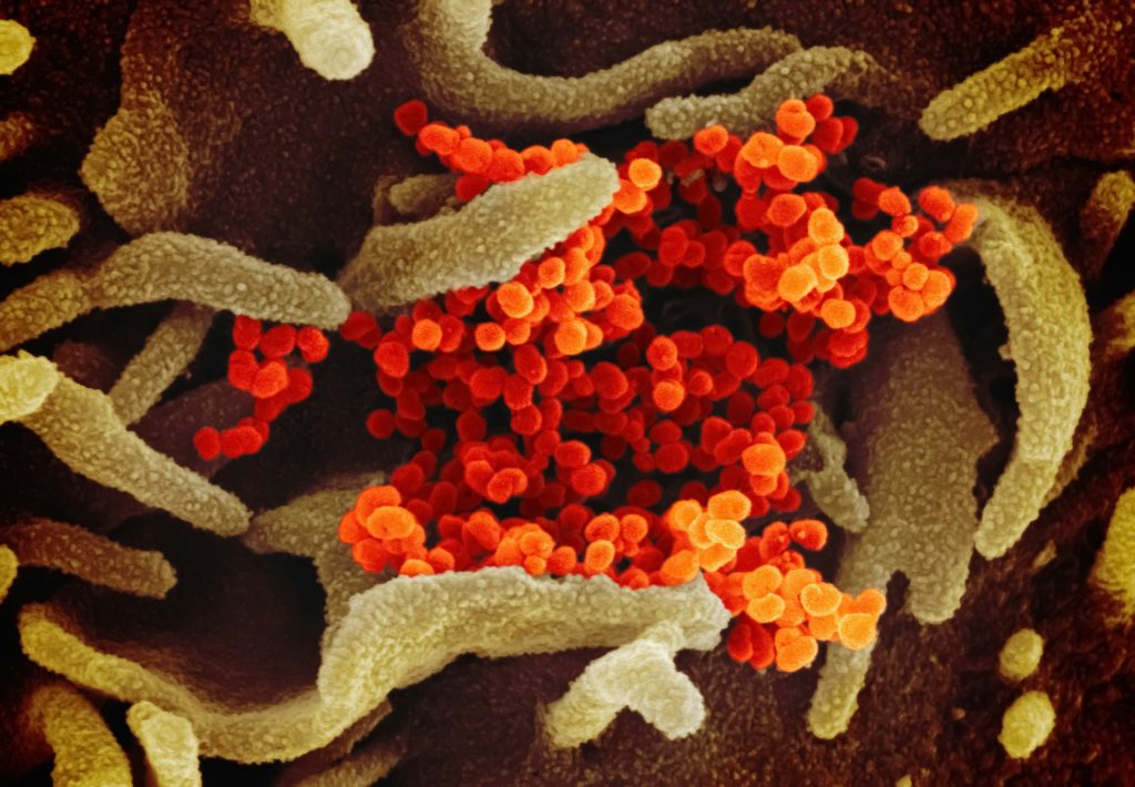 Hepatitis C Vaccine